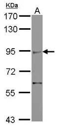 Anti-ZMIZ2 antibody [C1C3] used in Western Blot (WB). GTX118779