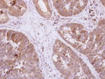 Anti-DIS3L2 antibody [N2C1], Internal used in IHC (Paraffin sections) (IHC-P). GTX118786