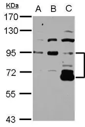 Anti-DIS3L2 antibody [N2C1], Internal used in Western Blot (WB). GTX118786