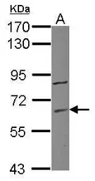 Anti-ZNF282 antibody [N1N3] used in Western Blot (WB). GTX118812