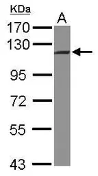 Anti-INTS5 antibody [C2C3], C-term used in Western Blot (WB). GTX118831