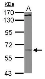 Anti-KIF19 antibody [N1N3] used in Western Blot (WB). GTX118841
