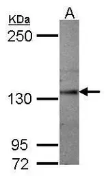 Anti-Semaphorin 5A antibody [C1C3] used in Western Blot (WB). GTX118856