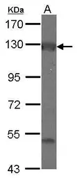 Anti-Adenylate cyclase 2 antibody [C2C3], C-term used in Western Blot (WB). GTX118857