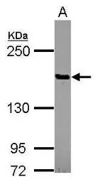 Anti-Pez antibody [N1N2], N-term used in Western Blot (WB). GTX118862