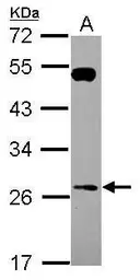 Anti-RAB26 antibody [N2C3-2] used in Western Blot (WB). GTX118872