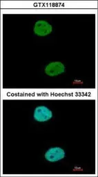 Anti-GTF3C4 antibody used in Immunocytochemistry/ Immunofluorescence (ICC/IF). GTX118874