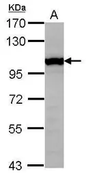Anti-GTF3C4 antibody used in Western Blot (WB). GTX118874