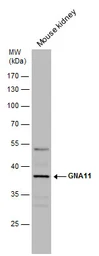 Anti-GNA11 antibody [N3C3] used in Western Blot (WB). GTX118876
