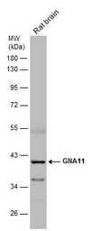 Anti-GNA11 antibody [N3C3] used in Western Blot (WB). GTX118876