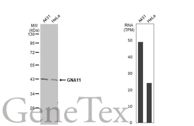 Anti-GNA11 antibody [N3C3] used in Western Blot (WB). GTX118876