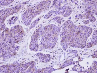 Anti-C8B antibody used in IHC (Paraffin sections) (IHC-P). GTX118877