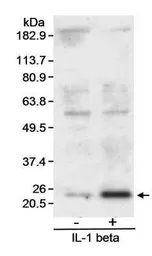 Anti-SOD2 antibody used in Western Blot (WB). GTX11888