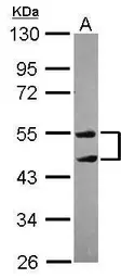 Anti-TRIM10 antibody [N1C1] used in Western Blot (WB). GTX118880