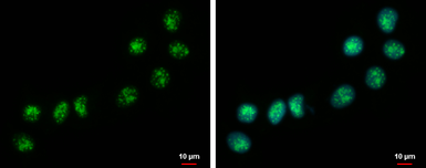 Anti-TP53TG5 antibody used in Immunocytochemistry/ Immunofluorescence (ICC/IF). GTX118881