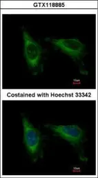 Anti-CDC37L1 antibody [N1C2] used in Immunocytochemistry/ Immunofluorescence (ICC/IF). GTX118885