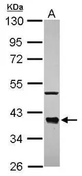 Anti-CDC37L1 antibody [N1C2] used in Western Blot (WB). GTX118885