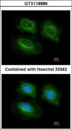 Anti-PDE10A antibody [C2C3], C-term used in Immunocytochemistry/ Immunofluorescence (ICC/IF). GTX118886