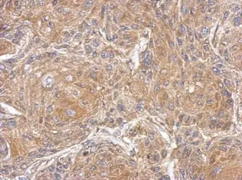 Anti-PDE10A antibody [C2C3], C-term used in IHC (Paraffin sections) (IHC-P). GTX118886