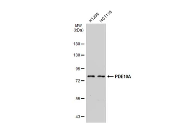 Anti-PDE10A antibody [C2C3], C-term used in Western Blot (WB). GTX118886