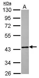 Anti-TXNL2 antibody [N1C2] used in Western Blot (WB). GTX118893