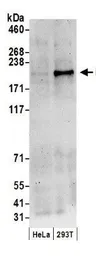 Anti-DNMT1 antibody used in Western Blot (WB). GTX11891