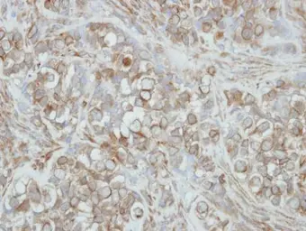 Anti-PCDHA3 antibody [N1N2], N-term used in IHC (Paraffin sections) (IHC-P). GTX118920