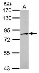 Anti-PCDHA3 antibody [N1N2], N-term used in Western Blot (WB). GTX118920