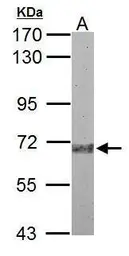 Anti-Plasma Kallikrein 1B antibody used in Western Blot (WB). GTX118926