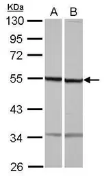 Anti-beta Tubulin antibody [N1C1] used in Western Blot (WB). GTX118928