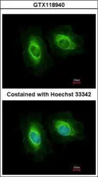 Anti-SASS6 antibody [N2C1], Internal used in Immunocytochemistry/ Immunofluorescence (ICC/IF). GTX118940