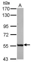 Anti-SASS6 antibody [N2C1], Internal used in Western Blot (WB). GTX118940