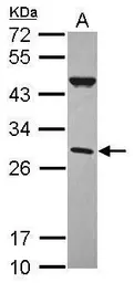 Anti-CFHL2 antibody [N1C2] used in Western Blot (WB). GTX118941