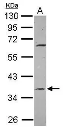 Anti-METTL2B antibody [N1C2] used in Western Blot (WB). GTX118942