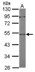 Anti-ACTL7A antibody [N1C2] used in Western Blot (WB). GTX118944