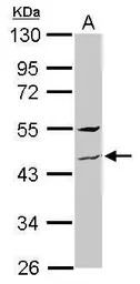 Anti-ZNF514 antibody [N1C1] used in Western Blot (WB). GTX118950