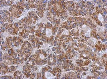 Anti-ZSWIM2 antibody [N1N3] used in IHC (Paraffin sections) (IHC-P). GTX118963