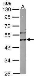 Anti-RIPX antibody [N1C1] used in Western Blot (WB). GTX118968