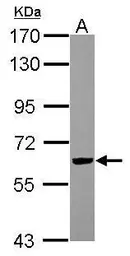 Anti-RIPX antibody [N1C1] used in Western Blot (WB). GTX118968