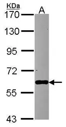Anti-mtPAP antibody [N1C1] used in Western Blot (WB). GTX118983