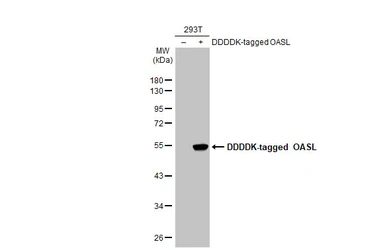 Anti-OASL antibody [N1C1] used in Western Blot (WB). GTX118999