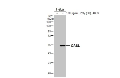 Anti-OASL antibody [N1C1] used in Western Blot (WB). GTX118999