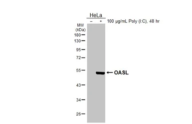 Anti-OASL antibody [N1C1] used in Western Blot (WB). GTX118999