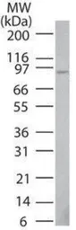 Anti-TNFAIP3 antibody [59A426] used in Western Blot (WB). GTX11900