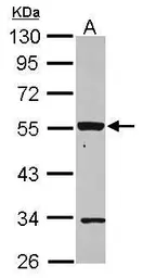 Anti-P2X2 antibody [N1C1] used in Western Blot (WB). GTX119003
