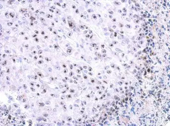 Anti-WDR74 antibody [N1C2] used in IHC (Paraffin sections) (IHC-P). GTX119013