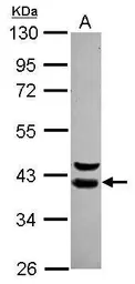 Anti-WDR74 antibody [N1C2] used in Western Blot (WB). GTX119013