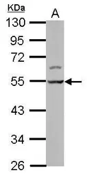 Anti-LSM11 antibody used in Western Blot (WB). GTX119023
