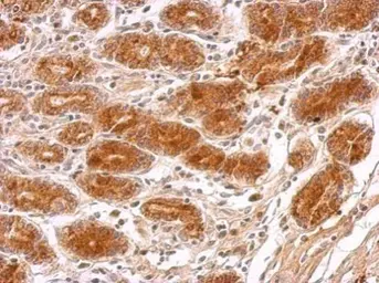 Anti-MRPS23 antibody used in IHC (Paraffin sections) (IHC-P). GTX119033
