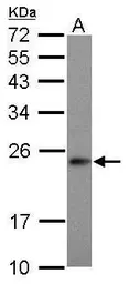 Anti-MRPS23 antibody used in Western Blot (WB). GTX119033